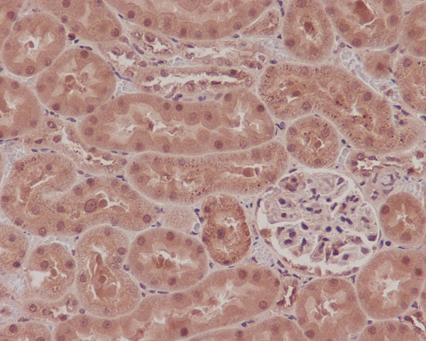 Anti-NADPH Oxidase 4 Rabbit Polyclonal Antibody