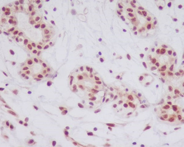 Anti-Phospho-JNK (Thr183) Rabbit Polyclonal Antibody