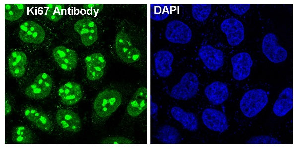 Anti-Ki67 Rabbit Polyclonal Antibody