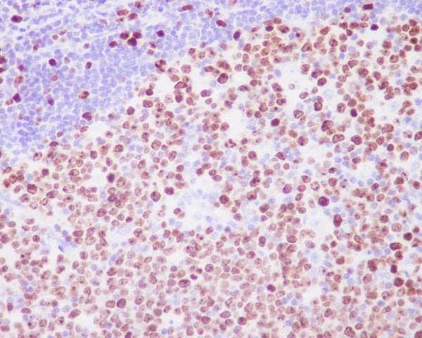 Anti-Ki67 Rabbit Polyclonal Antibody
