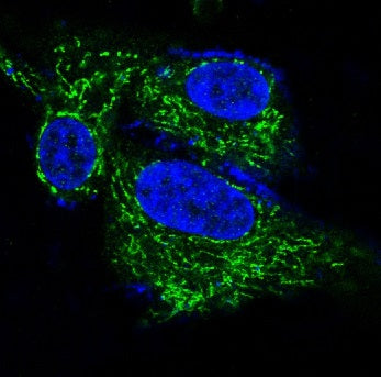 Anti-BDNF Rabbit Polyclonal Antibody