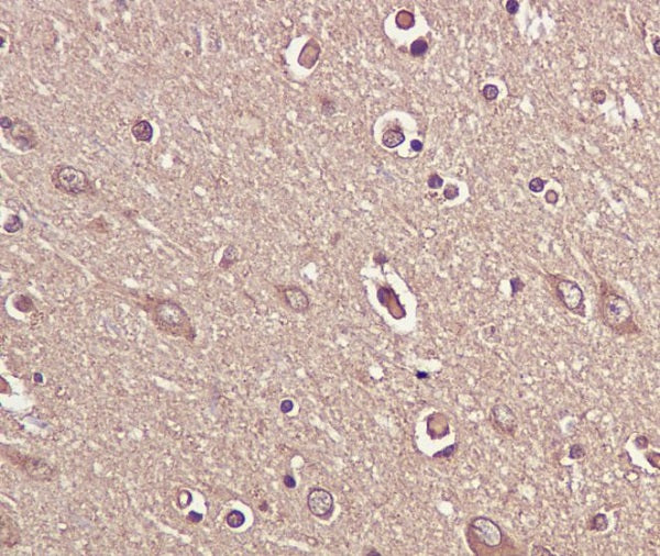 Anti-BDNF Rabbit Polyclonal Antibody