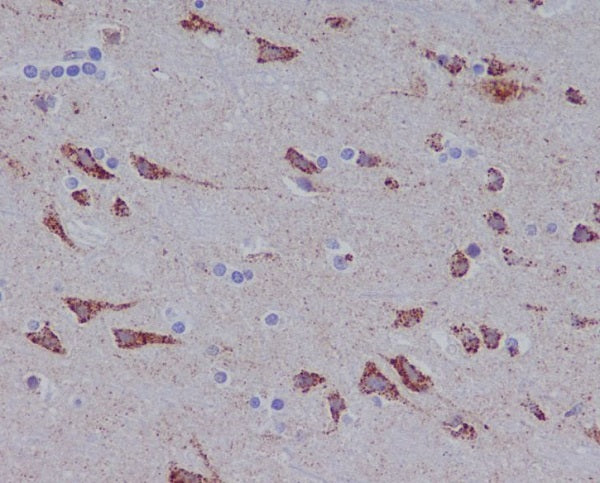 Anti-Glutaminase Rabbit Polyclonal Antibody