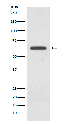 Anti-Glutaminase Rabbit Polyclonal Antibody