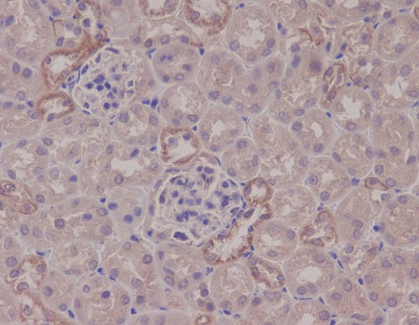 Anti-IKK alpha Rabbit Polyclonal Antibody
