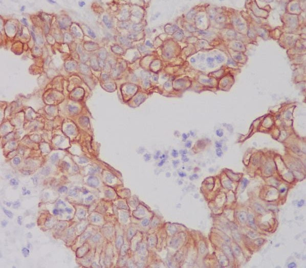 Anti-APG5L Rabbit Polyclonal Antibody