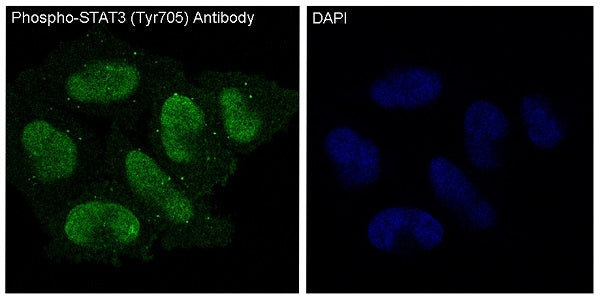 Anti-Phospho-STAT3 (Tyr705) Rabbit Polyclonal Antibody