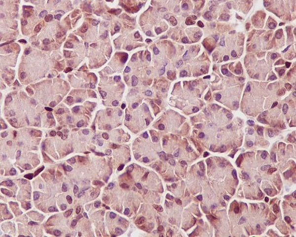 Anti-Phospho-STAT3 (Tyr705) Rabbit Polyclonal Antibody