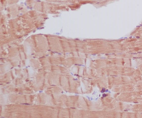Anti-MYH6 Rabbit Polyclonal Antibody