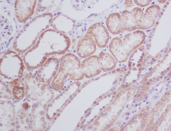 Anti-BNIP3 Rabbit Polyclonal Antibody