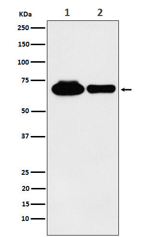 Anti-METTL3 Rabbit Polyclonal Antibody