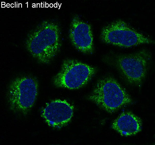 Anti-Beclin 1 Rabbit Polyclonal Antibody