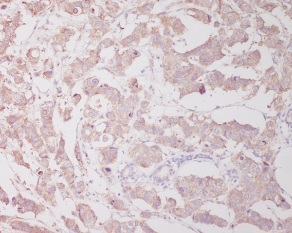 Anti-Beclin 1 Rabbit Polyclonal Antibody