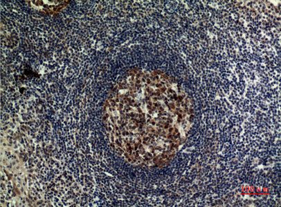 Anti-FOXP3 Rabbit Polyclonal Antibody