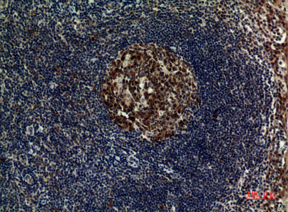Anti-FOXP3 Rabbit Polyclonal Antibody