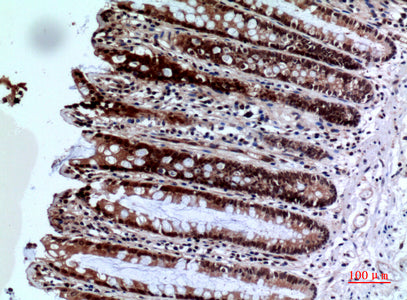 Anti-FOXP3 Rabbit Polyclonal Antibody