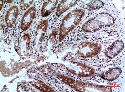Anti-FOXP3 Rabbit Polyclonal Antibody