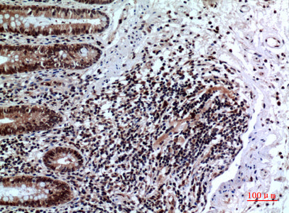 Anti-FOXP3 Rabbit Polyclonal Antibody
