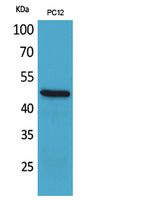 Anti-FOXP3 Rabbit Polyclonal Antibody