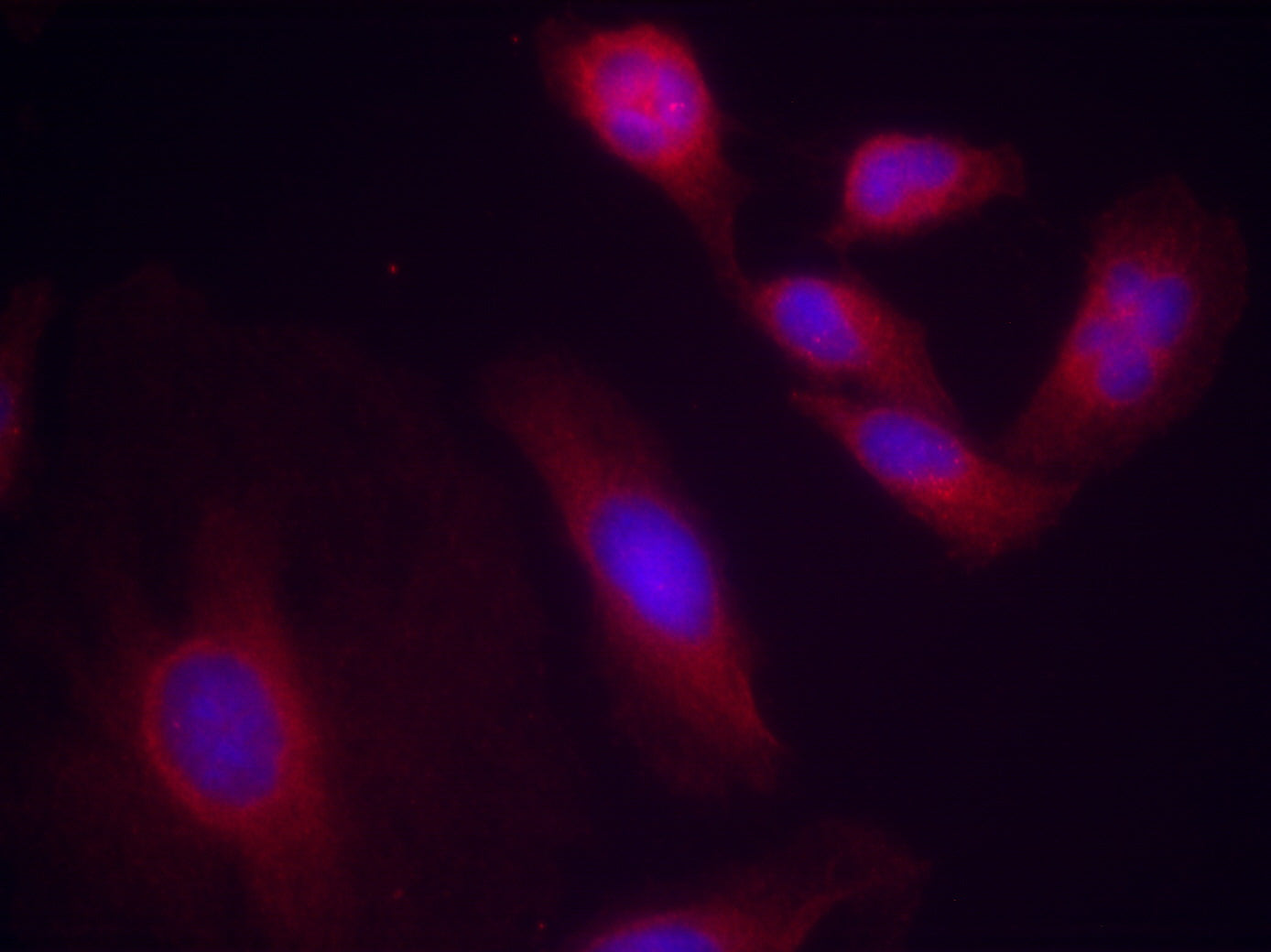 Anti-Phospho-NF-KB p65 (Ser536) Rabbit Polyclonal Antibody