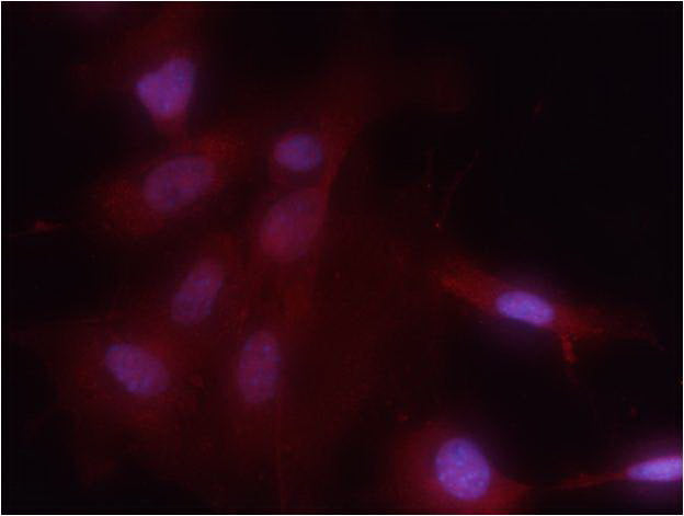 Anti-Phospho-NF-KB p65 (Ser536) Rabbit Polyclonal Antibody