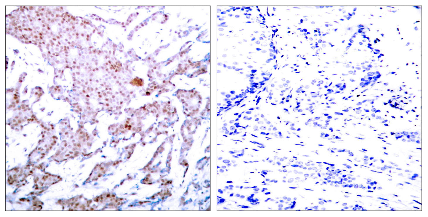 Anti-Phospho-NF-KB p65 (Ser536) Rabbit Polyclonal Antibody