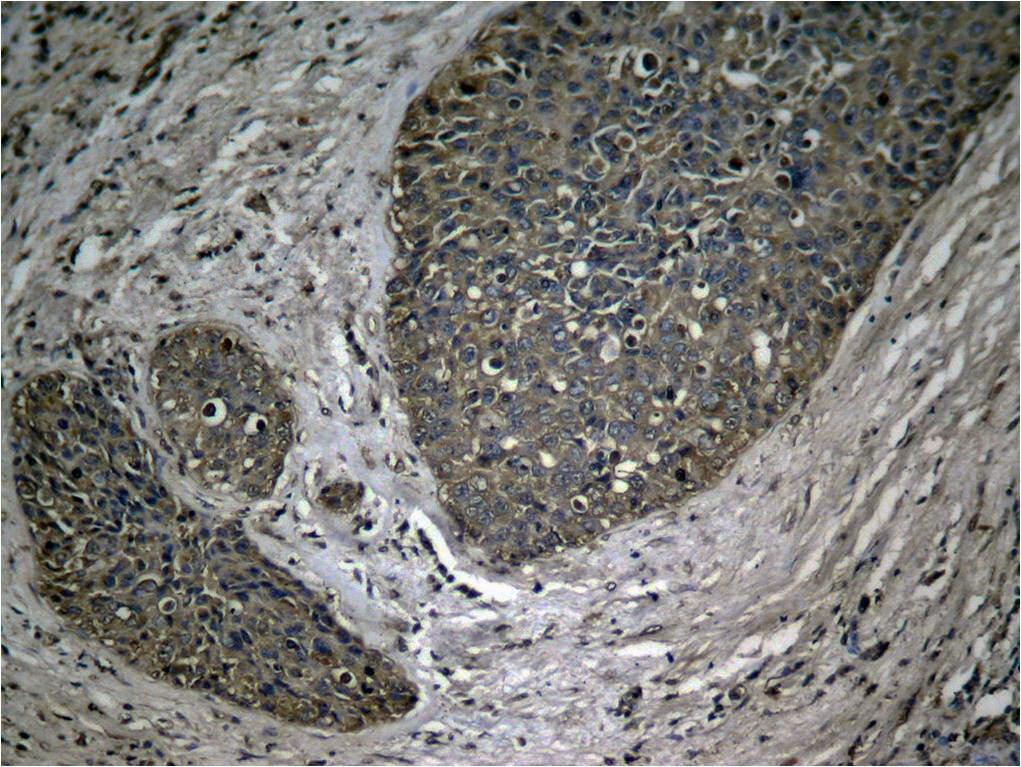 Anti-Phospho-NF-KB p65 (Ser536) Rabbit Polyclonal Antibody