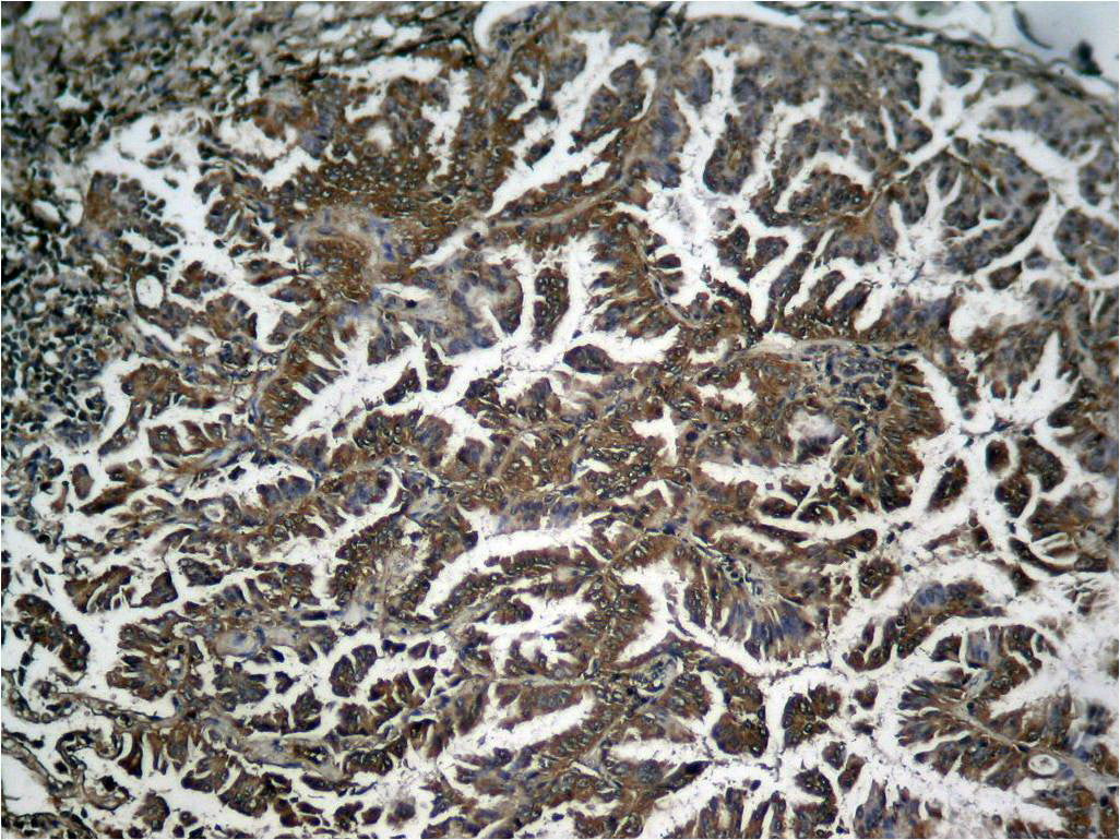 Anti-Phospho-NF-KB p65 (Ser536) Rabbit Polyclonal Antibody