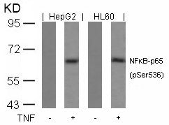 Anti-Phospho-NF-KB p65 (Ser536) Rabbit Polyclonal Antibody
