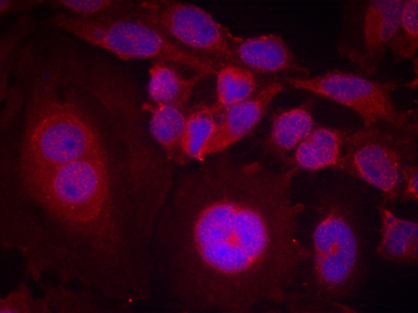 Anti-Phospho-STAT3 (Ser727) Rabbit Polyclonal Antibody