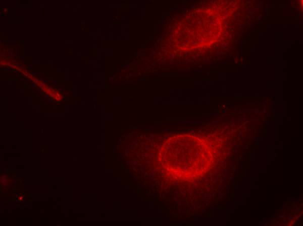Anti-Phospho-Cofilin (Ser3) Rabbit Polyclonal Antibody