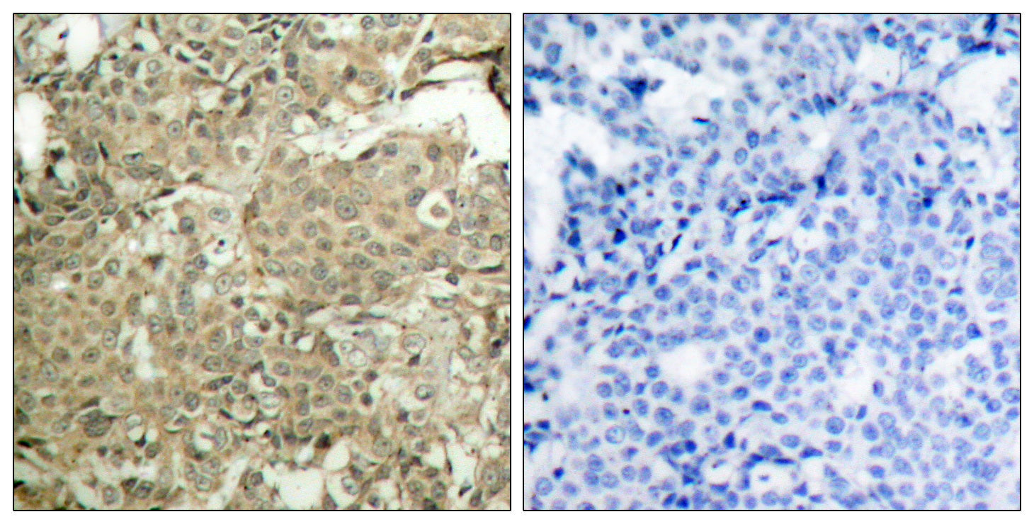Anti-Phospho-Cofilin (Ser3) Rabbit Polyclonal Antibody