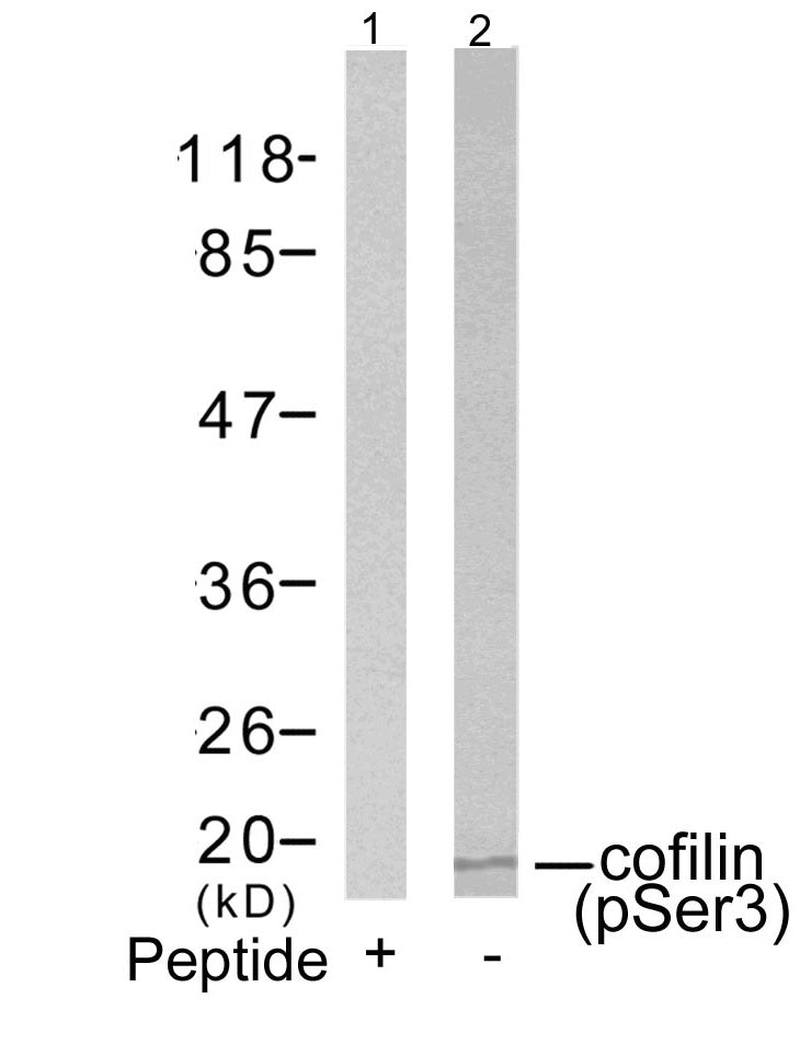 Anti-Phospho-Cofilin (Ser3) Rabbit Polyclonal Antibody