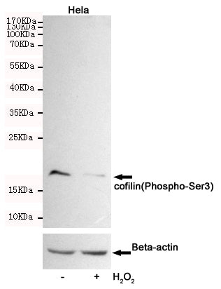 Anti-Phospho-Cofilin (Ser3) Rabbit Polyclonal Antibody
