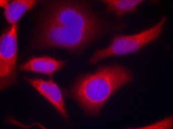 Anti-Phospho-AMPK alpha 1 (Ser496) Rabbit Polyclonal Antibody