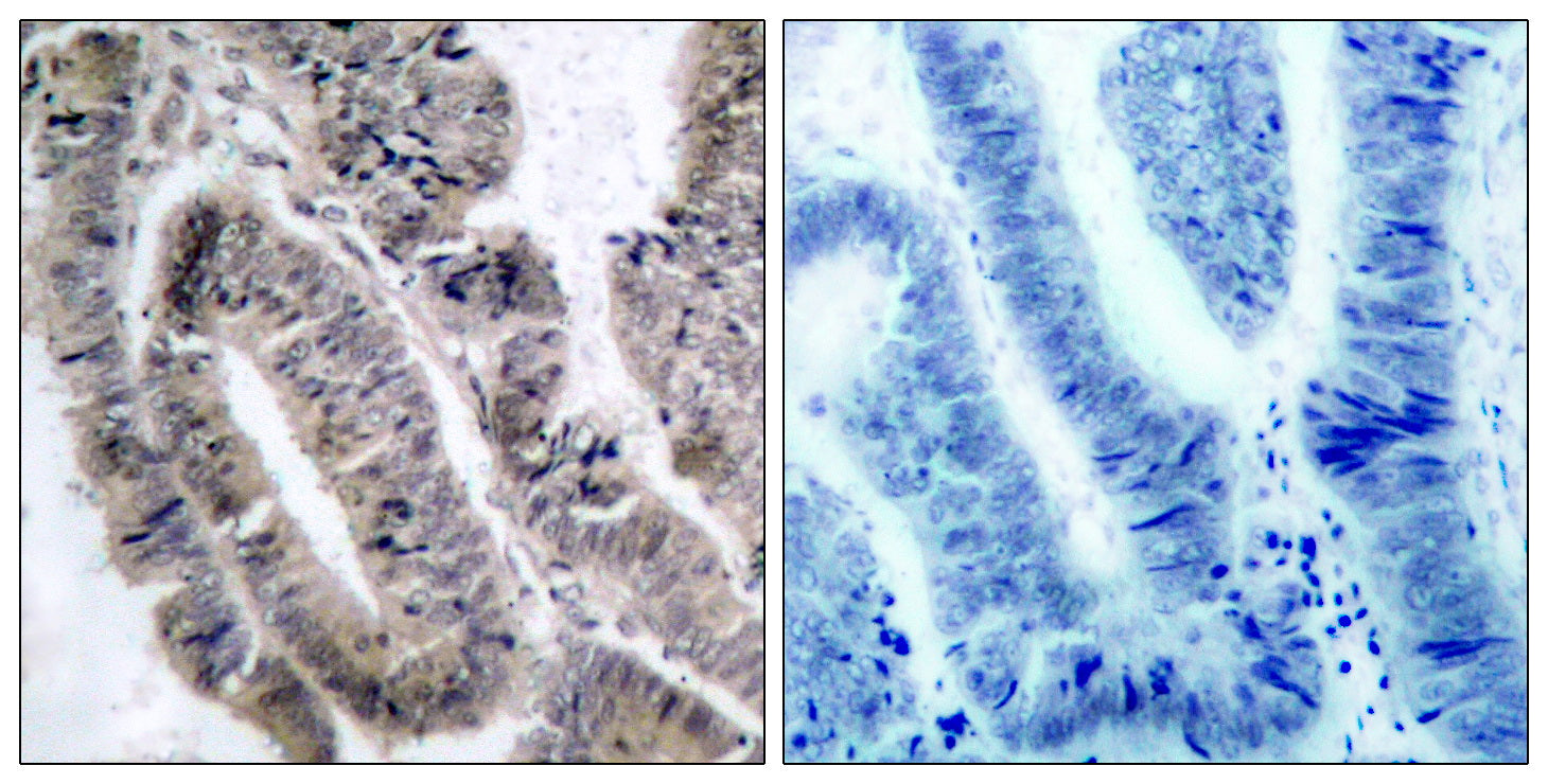 Anti-Phospho-AMPK alpha 1 (Ser496) Rabbit Polyclonal Antibody