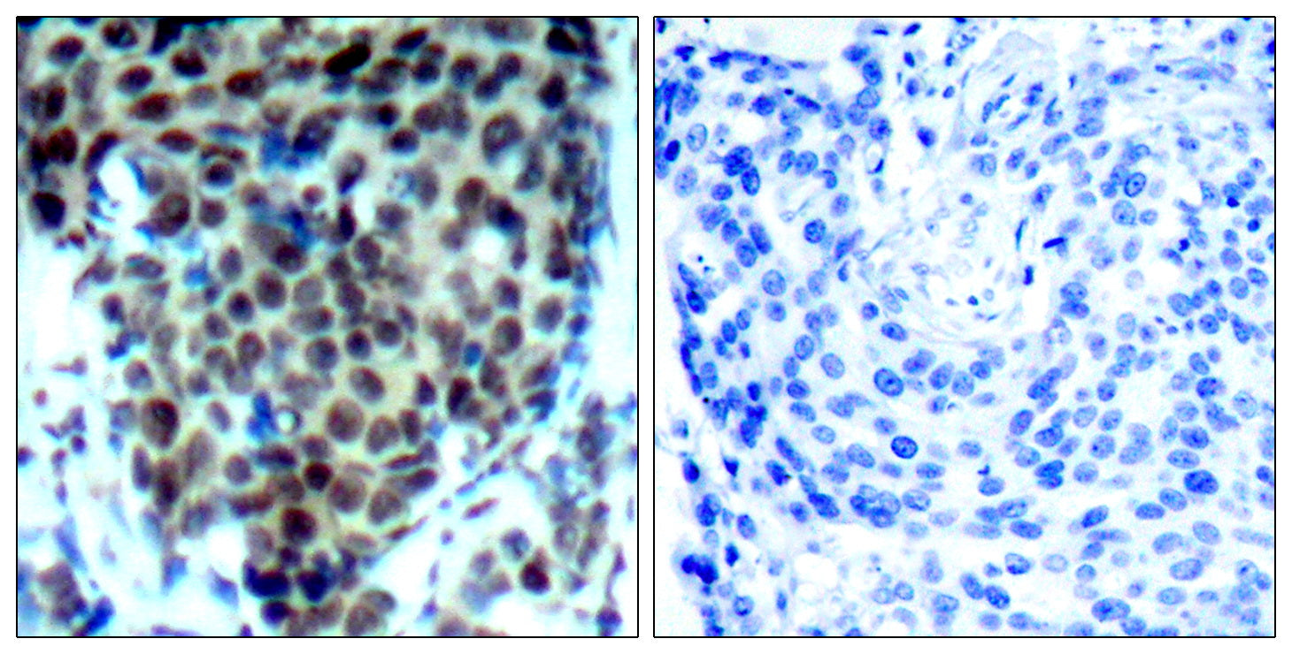 Anti-Phospho-p38 (Thr180) Rabbit Polyclonal Antibody