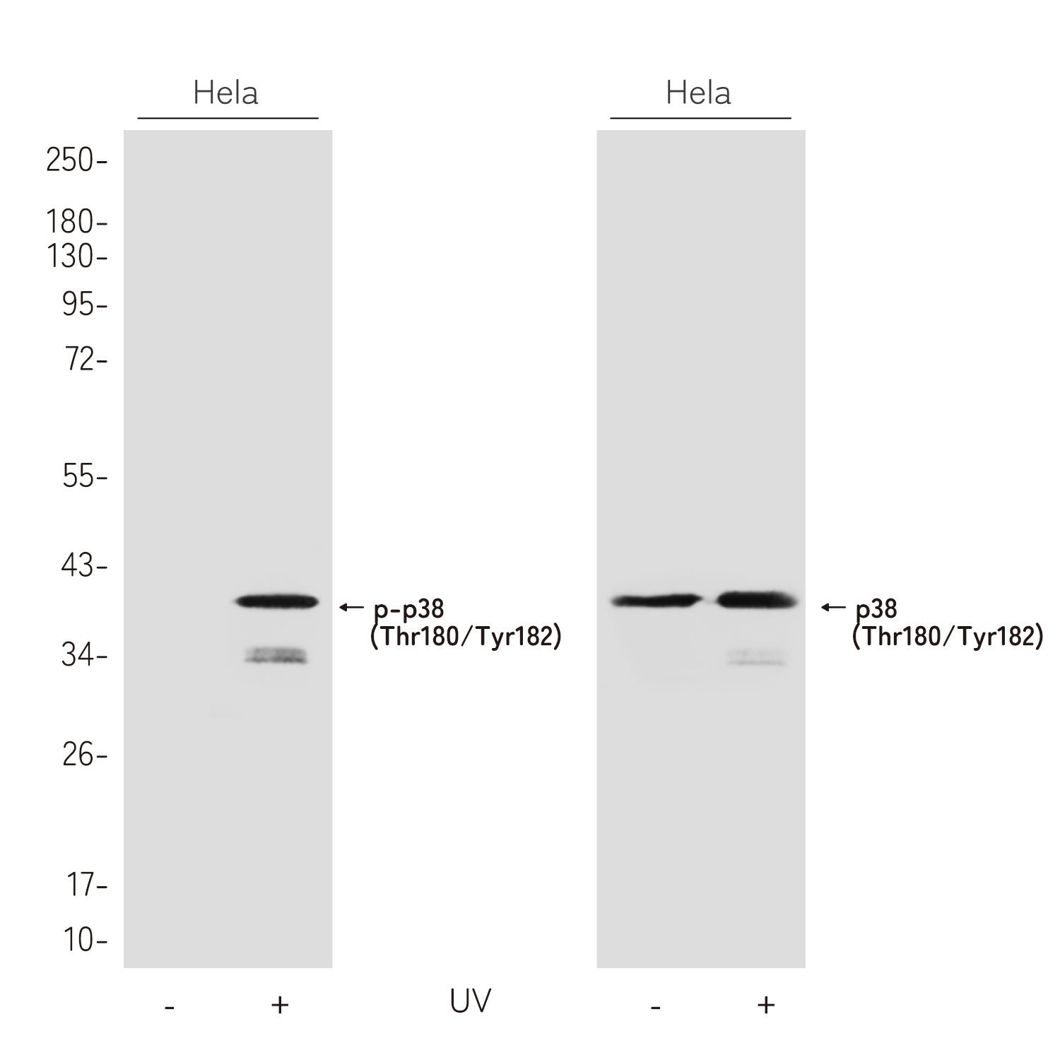 Anti-Phospho-p38 (Thr180/Tyr182) Rabbit Polyclonal Antibody