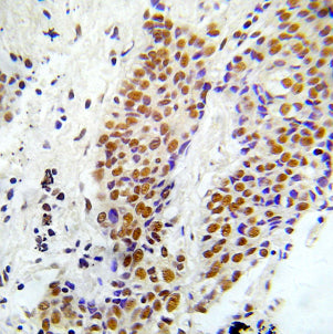 Anti-Phospho-ASK1 (Ser966) Rabbit Polyclonal Antibody