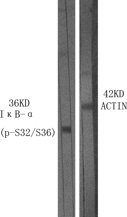 Anti-Phospho-IKB alpha (Ser32/Ser36) Rabbit Polyclonal Antibody