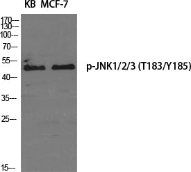 Anti-Phospho-JNK (Thr183/Tyr185) Rabbit Polyclonal Antibody