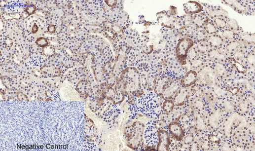 Anti-Phospho-PERK (Thr982) Rabbit Polyclonal Antibody