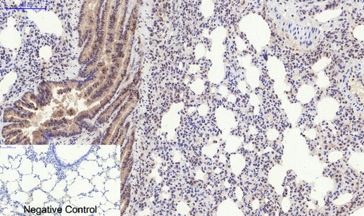 Anti-Phospho-PERK (Thr982) Rabbit Polyclonal Antibody