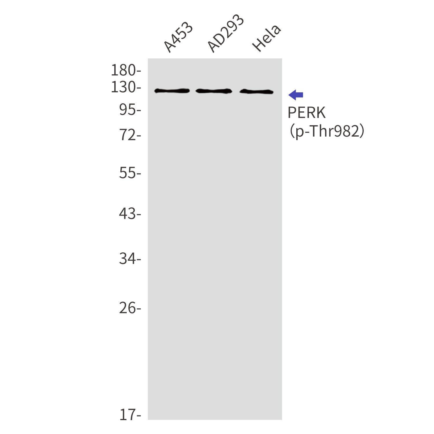 Anti-Phospho-PERK (Thr982) Rabbit Polyclonal Antibody