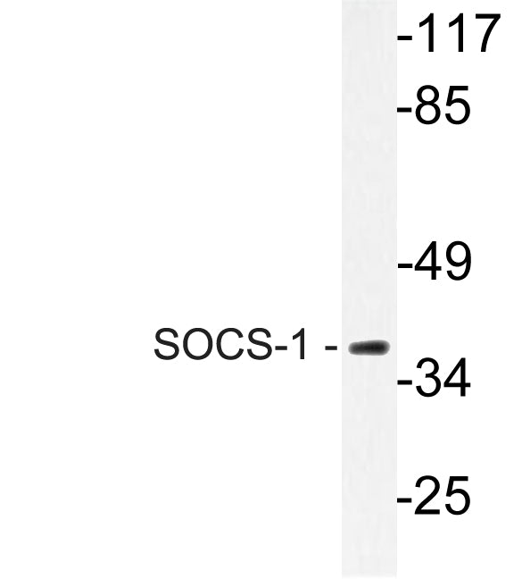 Anti-SOCS1 Rabbit Polyclonal Antibody