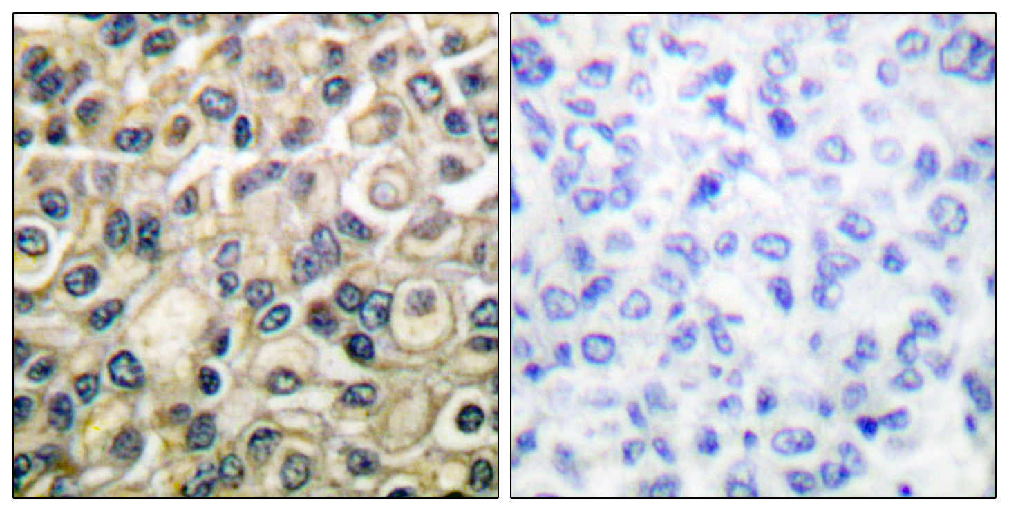 Anti-Claudin 1 Rabbit Polyclonal Antibody