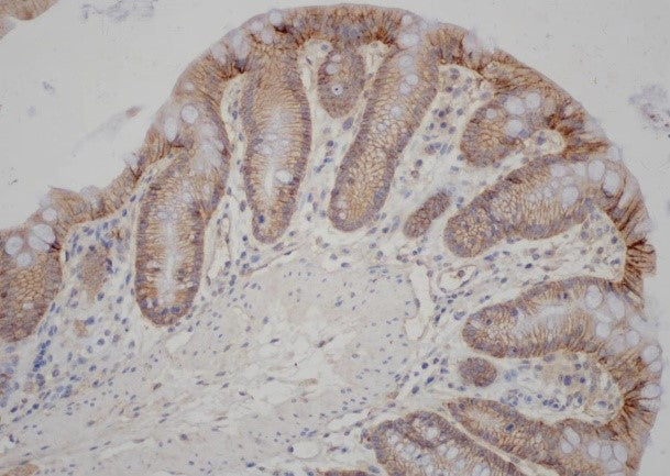 Anti-Claudin 1 Rabbit Polyclonal Antibody