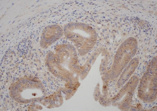Anti-Claudin 1 Rabbit Polyclonal Antibody