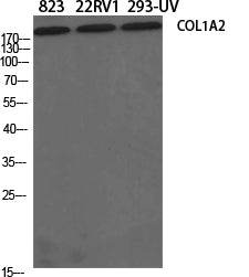 Anti-Collagen I alpha 2 Rabbit Polyclonal Antibody