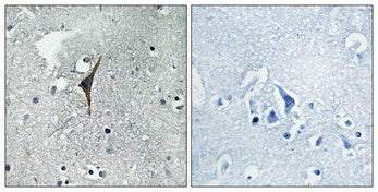 Anti-eNOS Rabbit Polyclonal Antibody